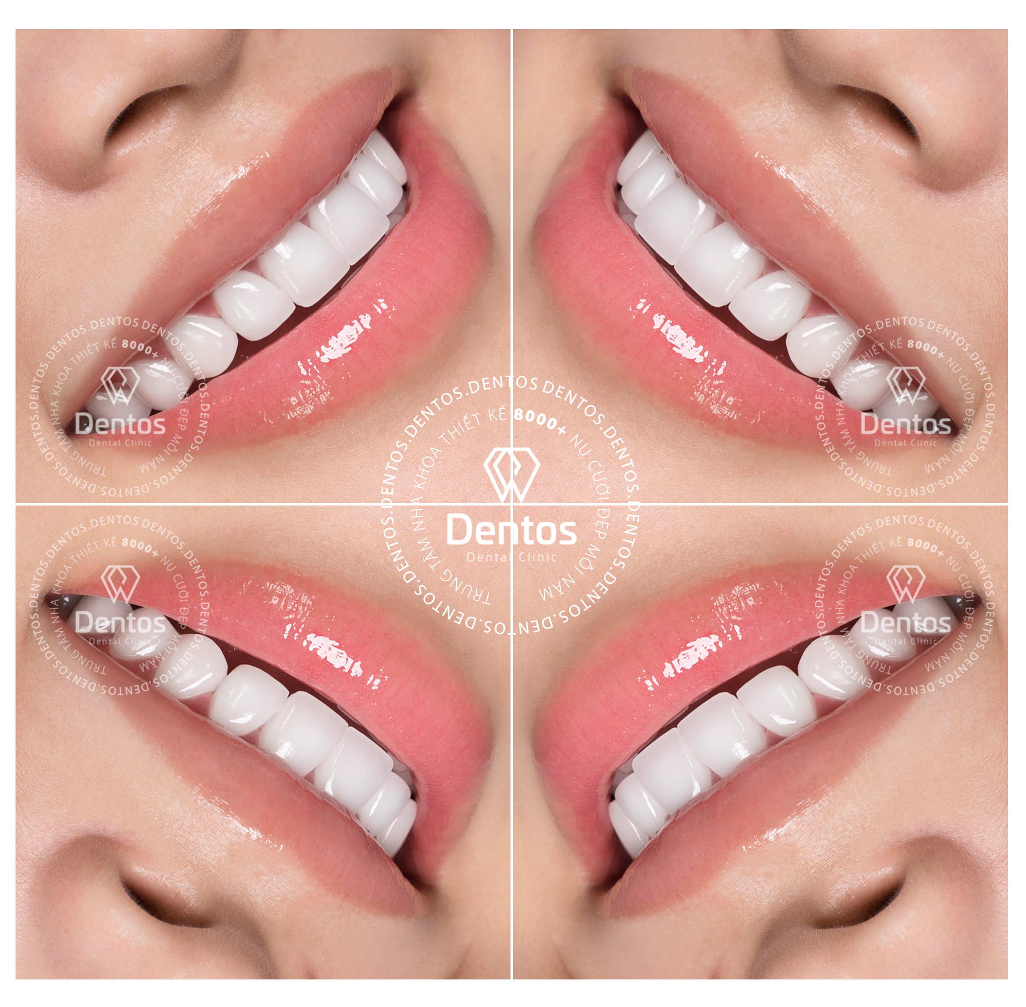 Răng sứ Orodent mang lại nụ cười sống động, tự nhiên như răng thật